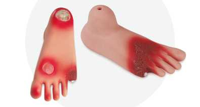 Diabetes Foot Model | Product Code：EX-NS6054